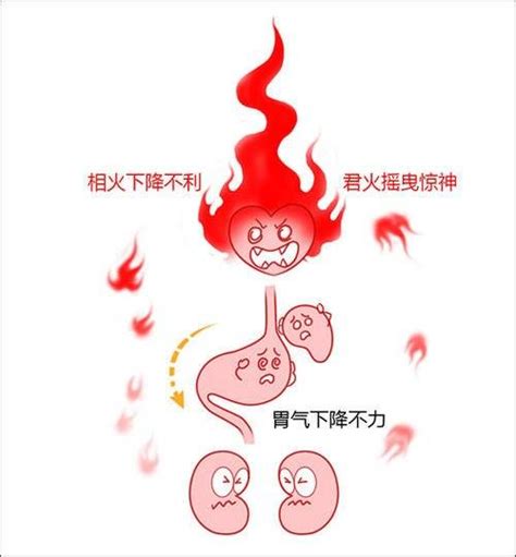 君火 相火|什么是君火？什么是相火？君火和相火啥关系？